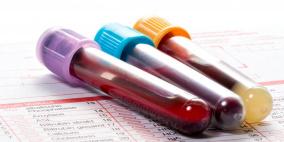 اختبار دم يكتشف 50 نوعا من السرطان.. النتائج واعدة